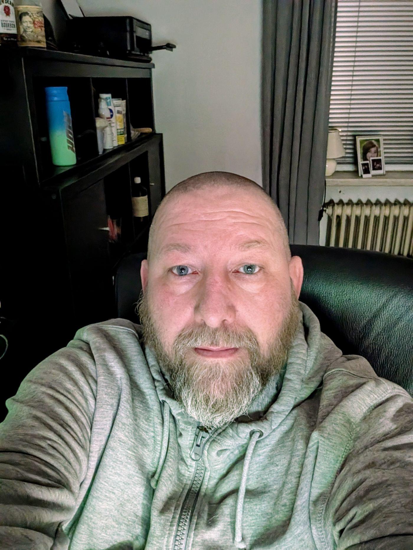 nach 8 Jahren endlich wie Glatze